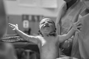 Midwife Services for Labor Induction